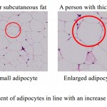 Enlargement of adipocites - face