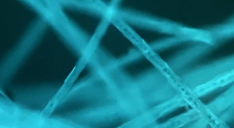 Luxury Recommendation